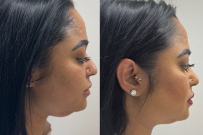 472603740_17936972294975702_6432724370953567881_n